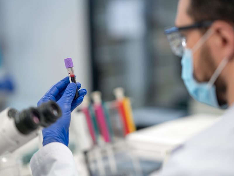 Detecção precoce do câncer ganha novas possibilidades com avanços na medicina diagnóstica